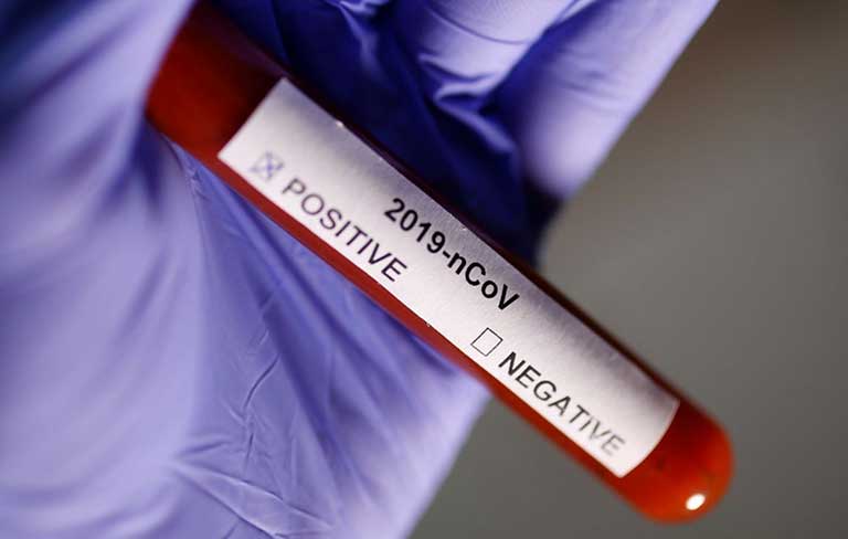 Karantinadaki Alman turistlerden bir kişide daha koronavirüs tespit edildi