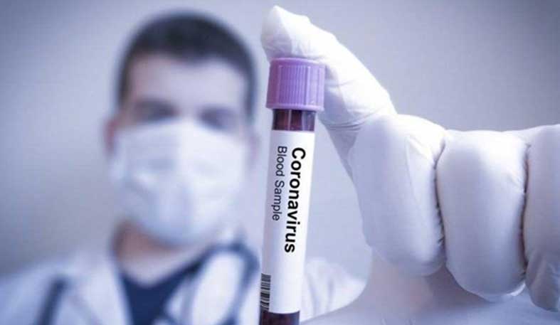 Ermenistan’da ilk koronavirüs vakası tespit edildi