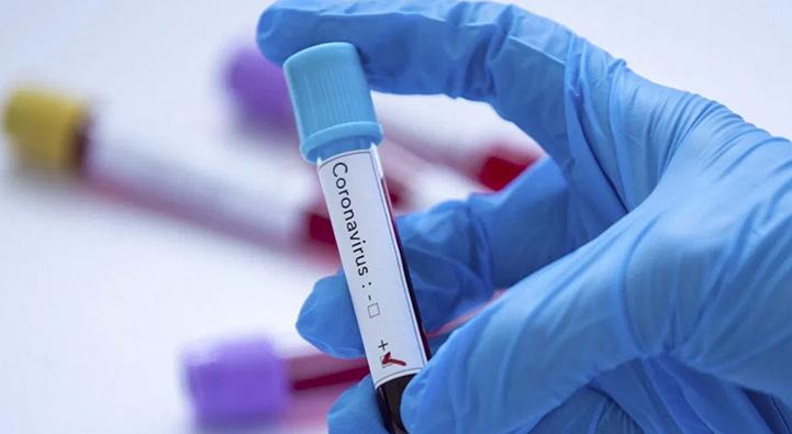 İran’da koronavirüsü nedeniyle 11 kişi daha öldü