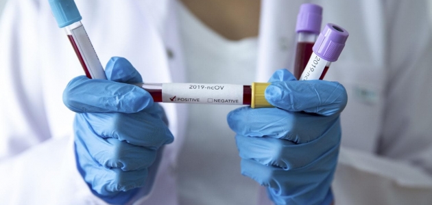 İngiltere’de ‘Beş dakikada sonuç veren’ koronavirüs testi deneniyor