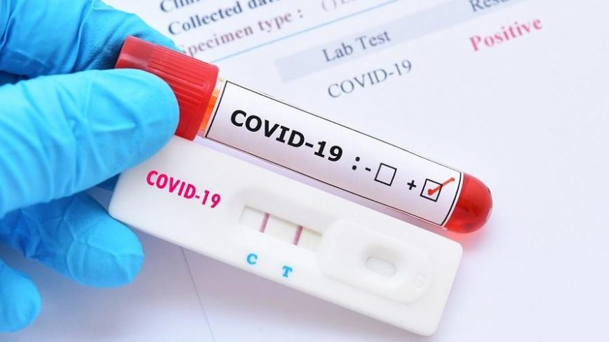 Koop-Süt’te Bir Personelin Covid-19 Test Sonucu Pozitif Çıktı