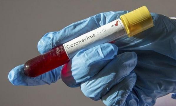 Türk Bilim İnsanları Coronavirüs Teşhisini 10 Saniyeye Düşüren Tanı Sistemi Geliştirdi