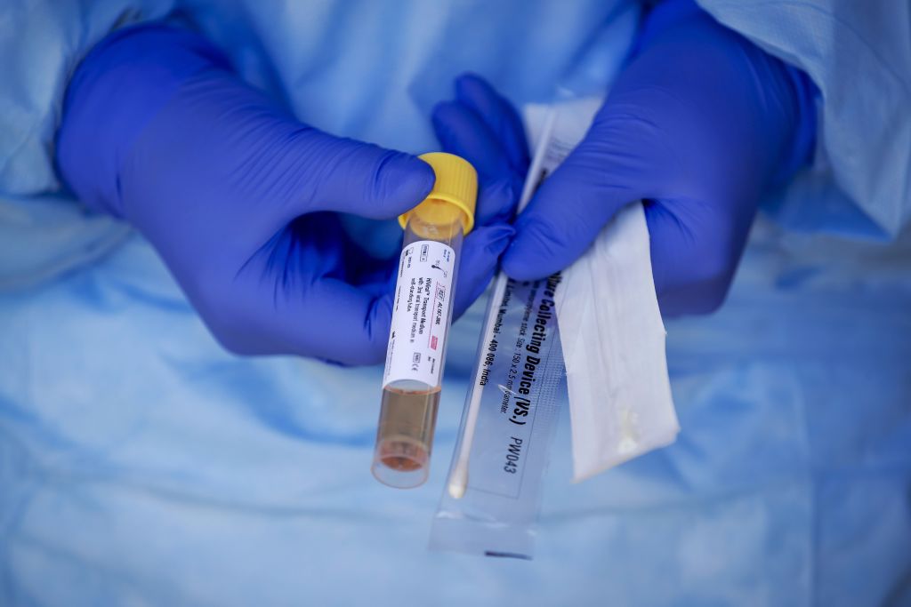 Alsancak ve Lapta Bölgesinde Test Sayıları Artırılacak, Düzenli ve Rastgele PCR Testleri Yapılacak.