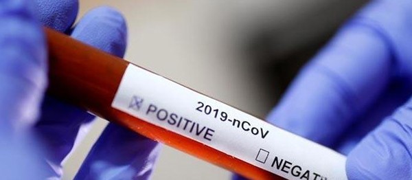 Güney Kıbrıs’ta 175 yeni koronavirüs vakası