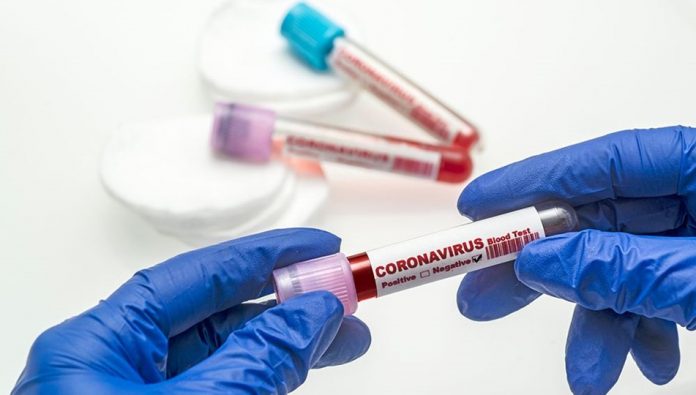 Güneyde koronavirüsten 4 kişi hayatını kaybetti